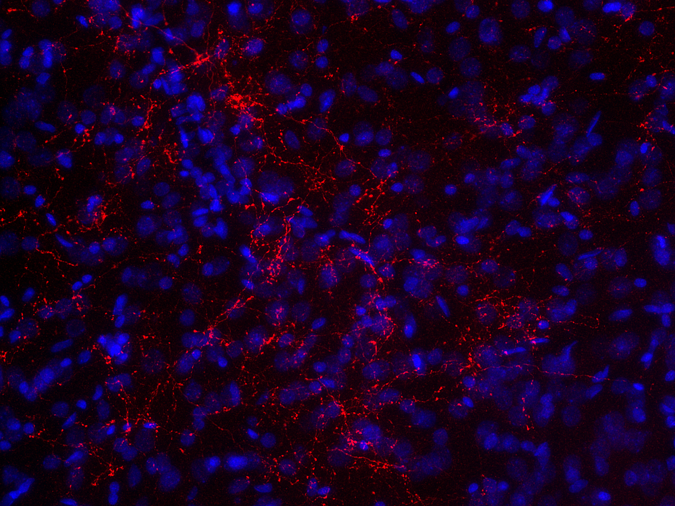 CGRP, Polyclonal Guinea pig antiserum