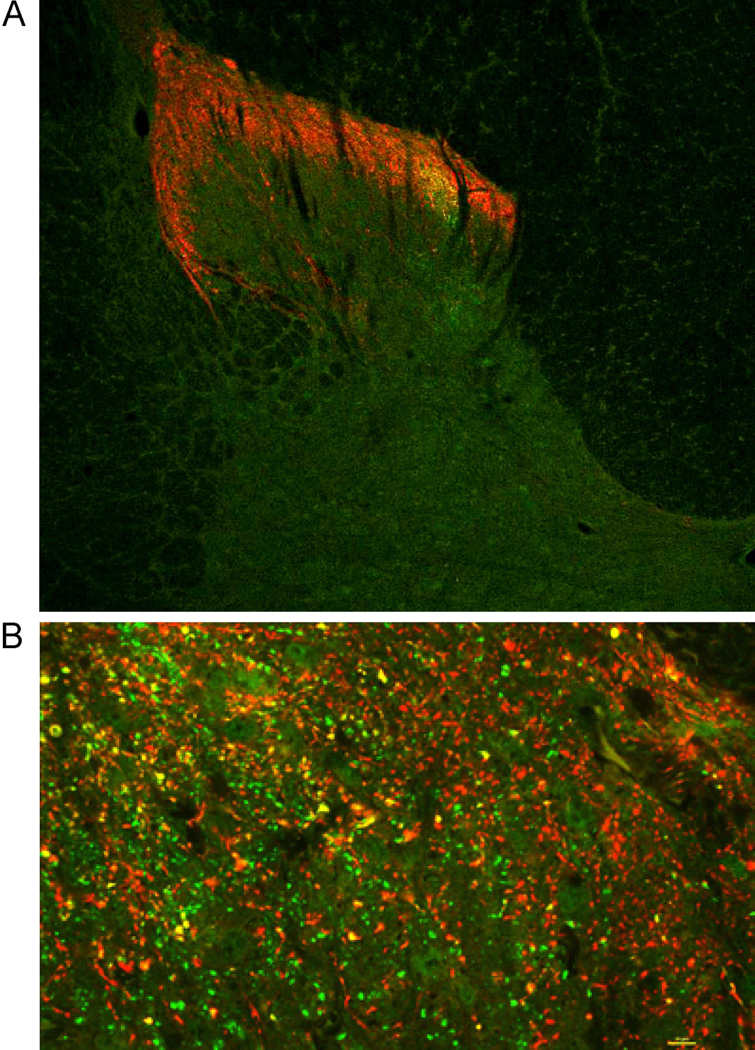 CGRP, Polyclonal Guinea pig antiserum