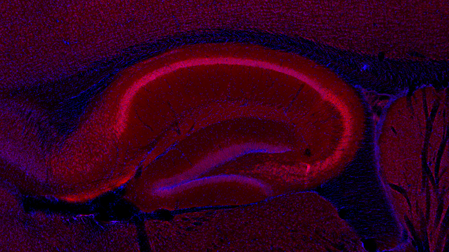 CPT1c Polyclonal rabbit purified antibody - image 4