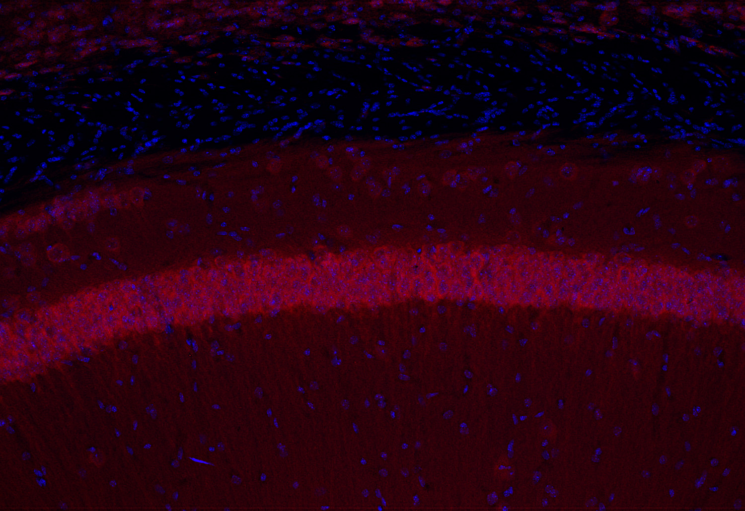CPT1c Polyclonal rabbit purified antibody - image 5