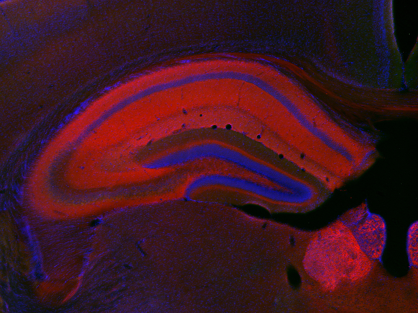 MDGA1 Polyclonal rabbit antiserum - image 1