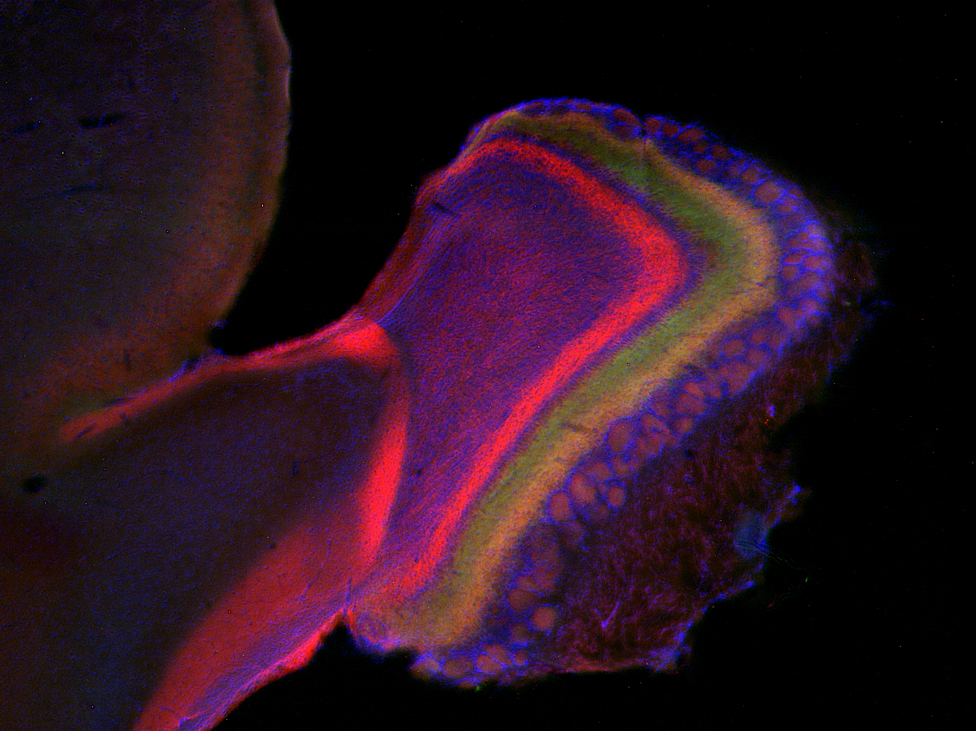 MDGA1 Polyclonal rabbit antiserum - image 3