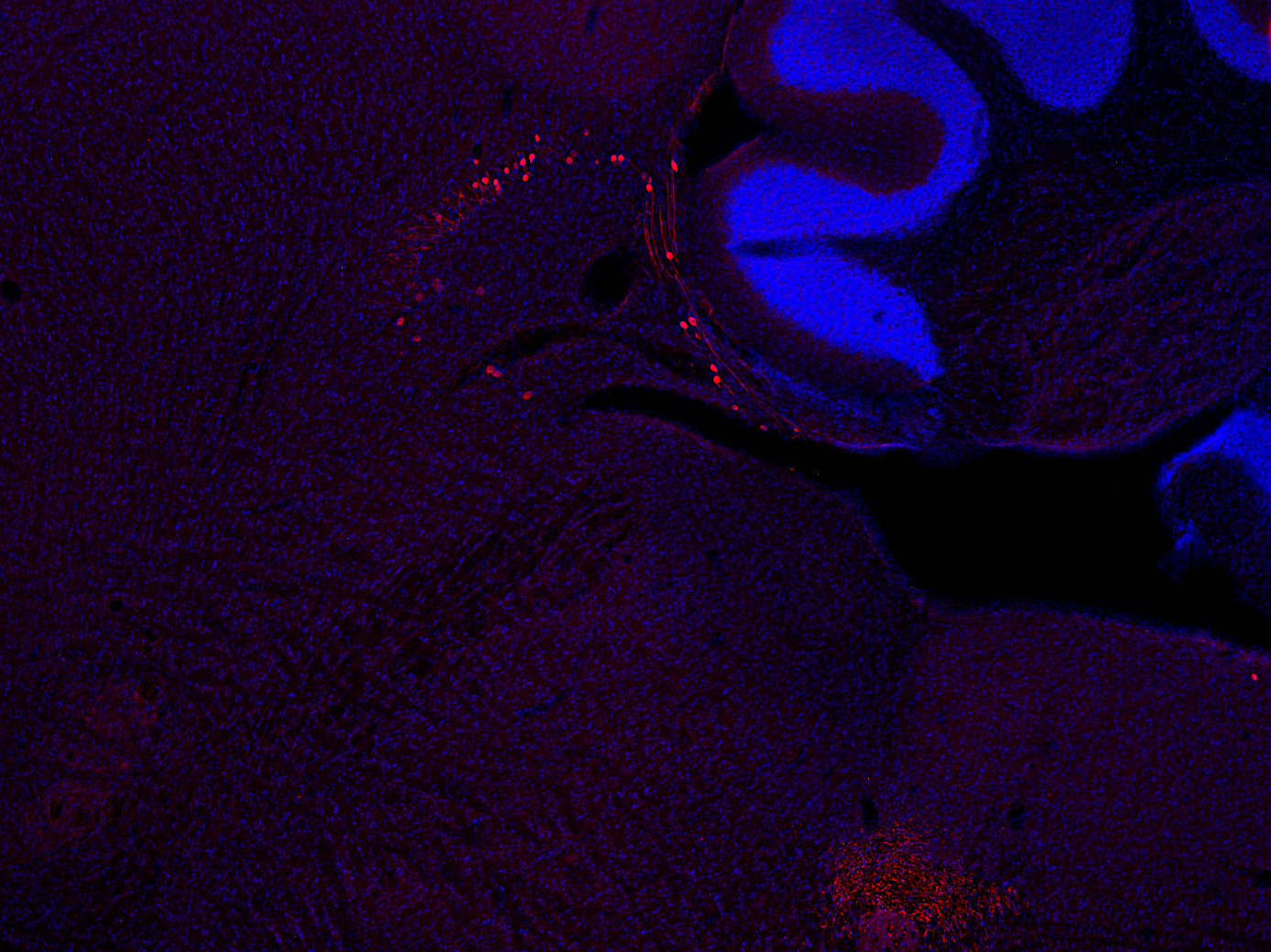 Peripherin1, Polyclonal Guinea pig antiserum