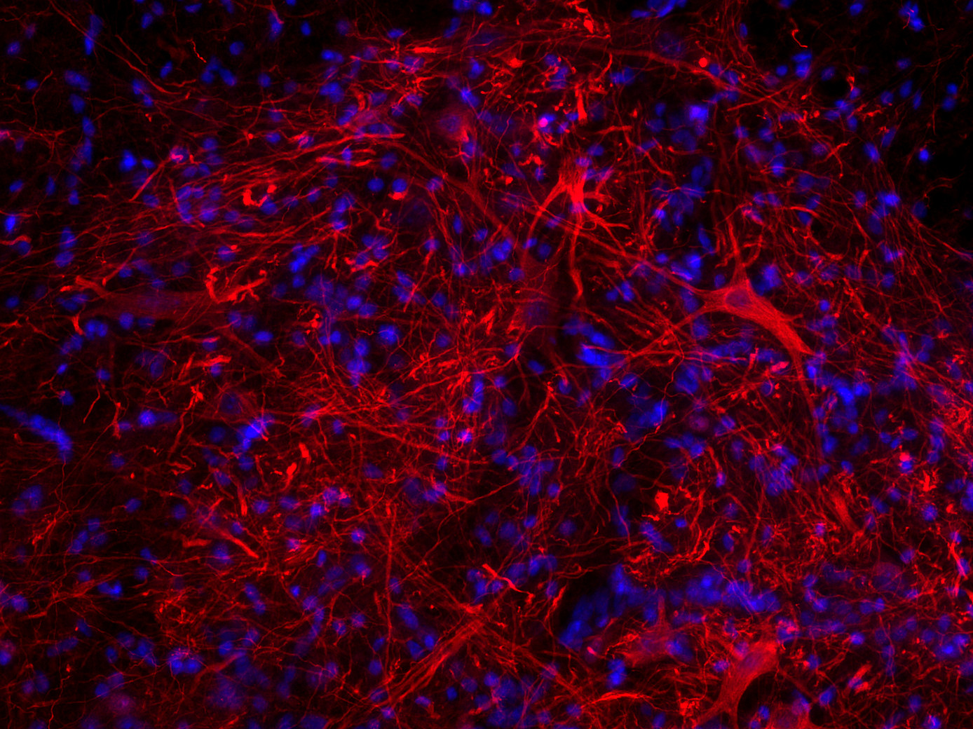 Peripherin1, Polyclonal Guinea pig antiserum
