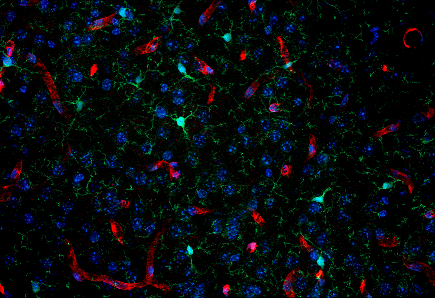 Aquaporin4 Recombinant chicken - image 3