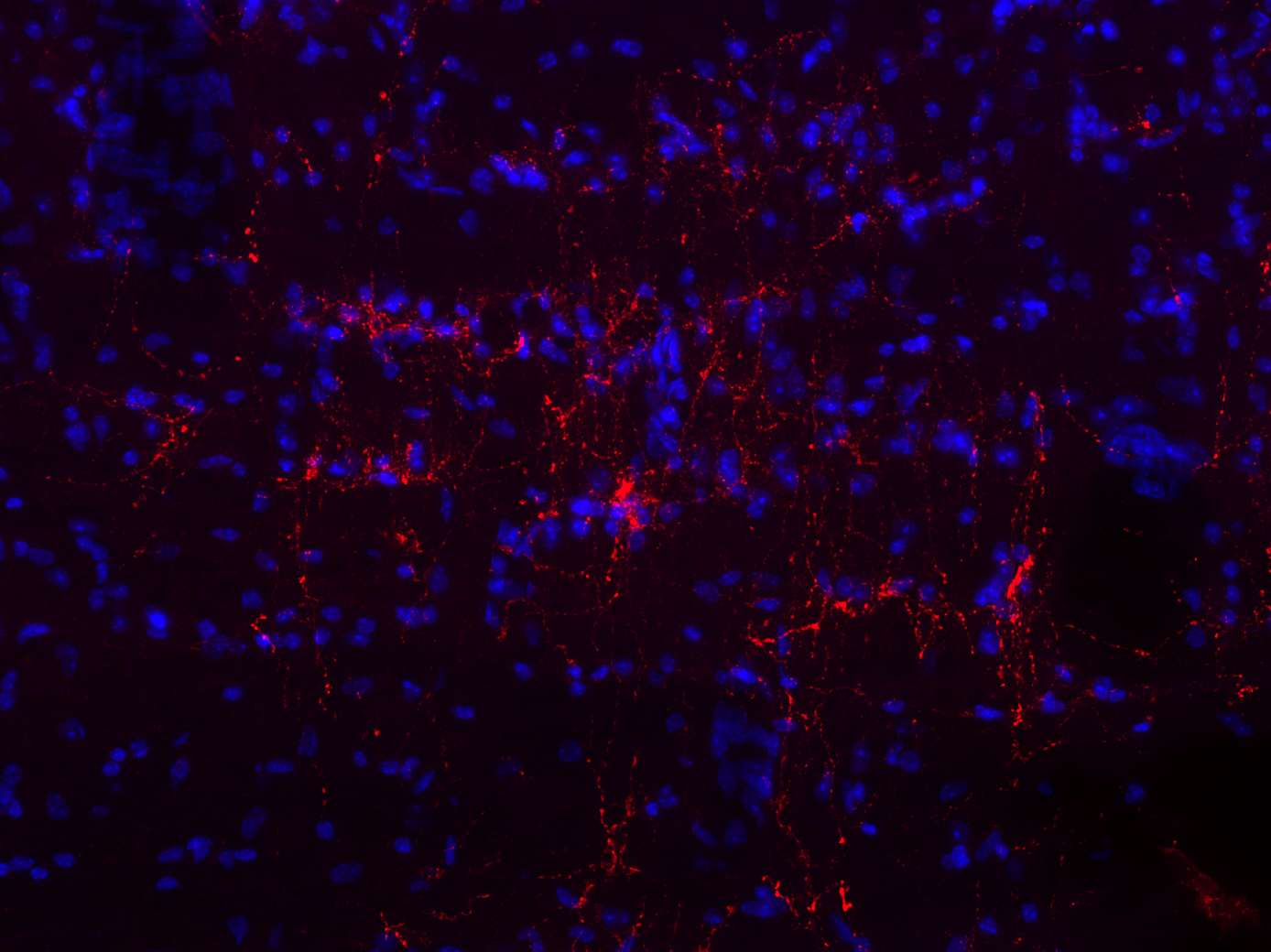 CCK-8, Polyclonal Guinea pig antiserum