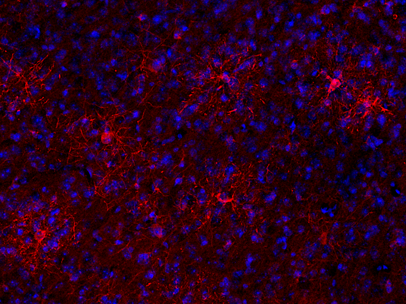 BCAS1 Polyclonal Guinea pig antiserum - image 3