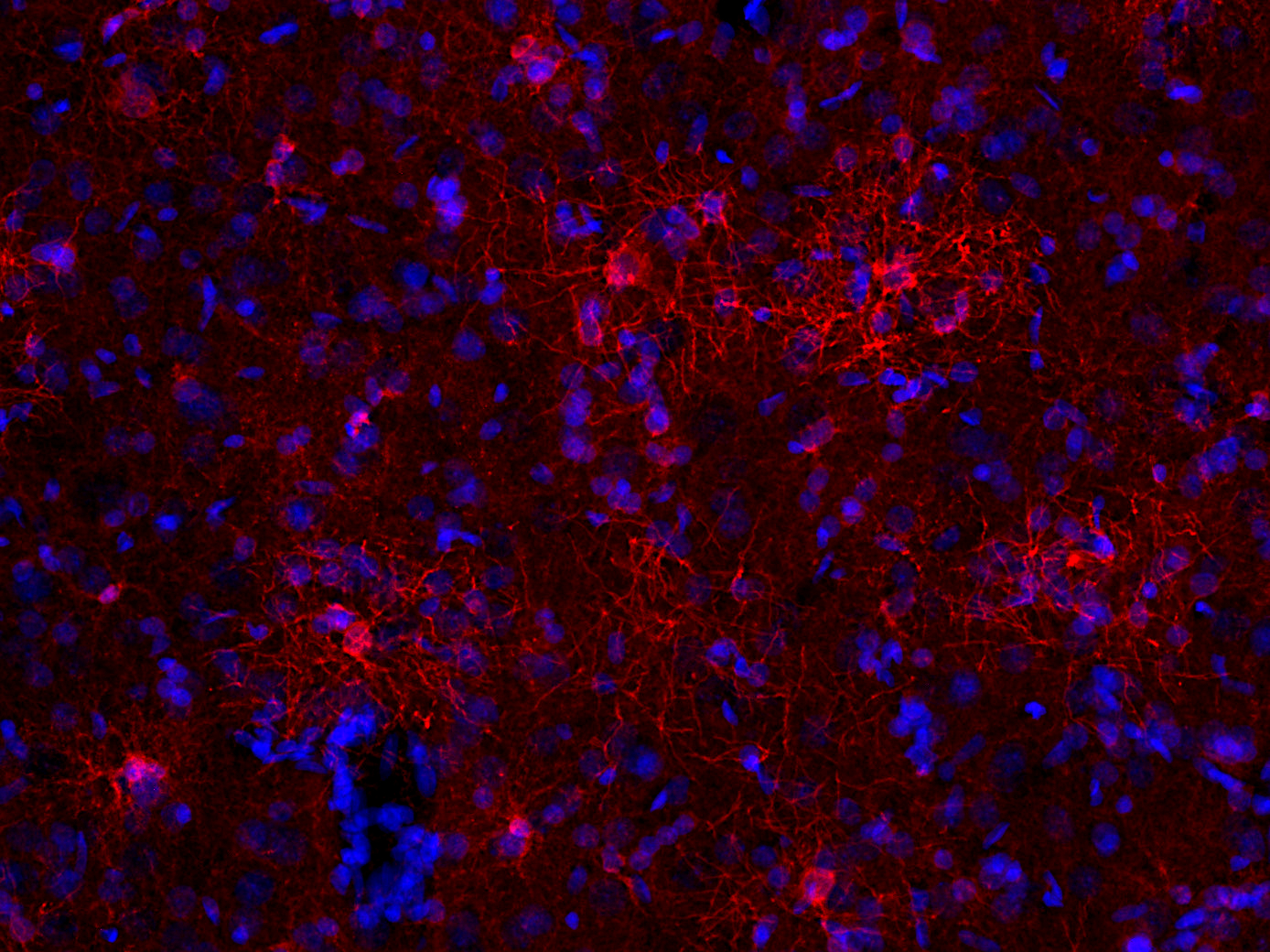 BCAS1 Polyclonal Guinea pig antiserum - image 4