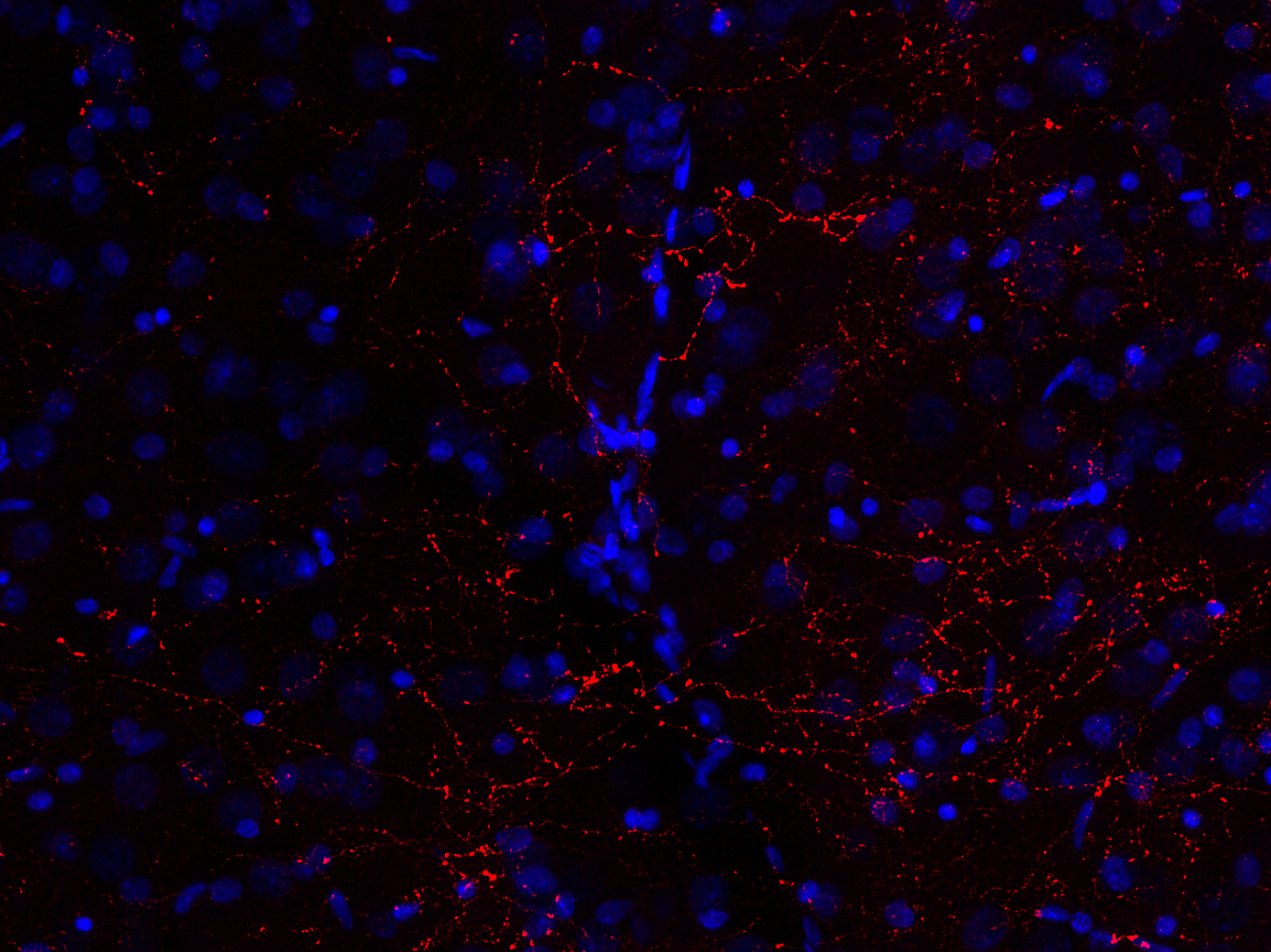 Galanin, Polyclonal Guinea pig antiserum