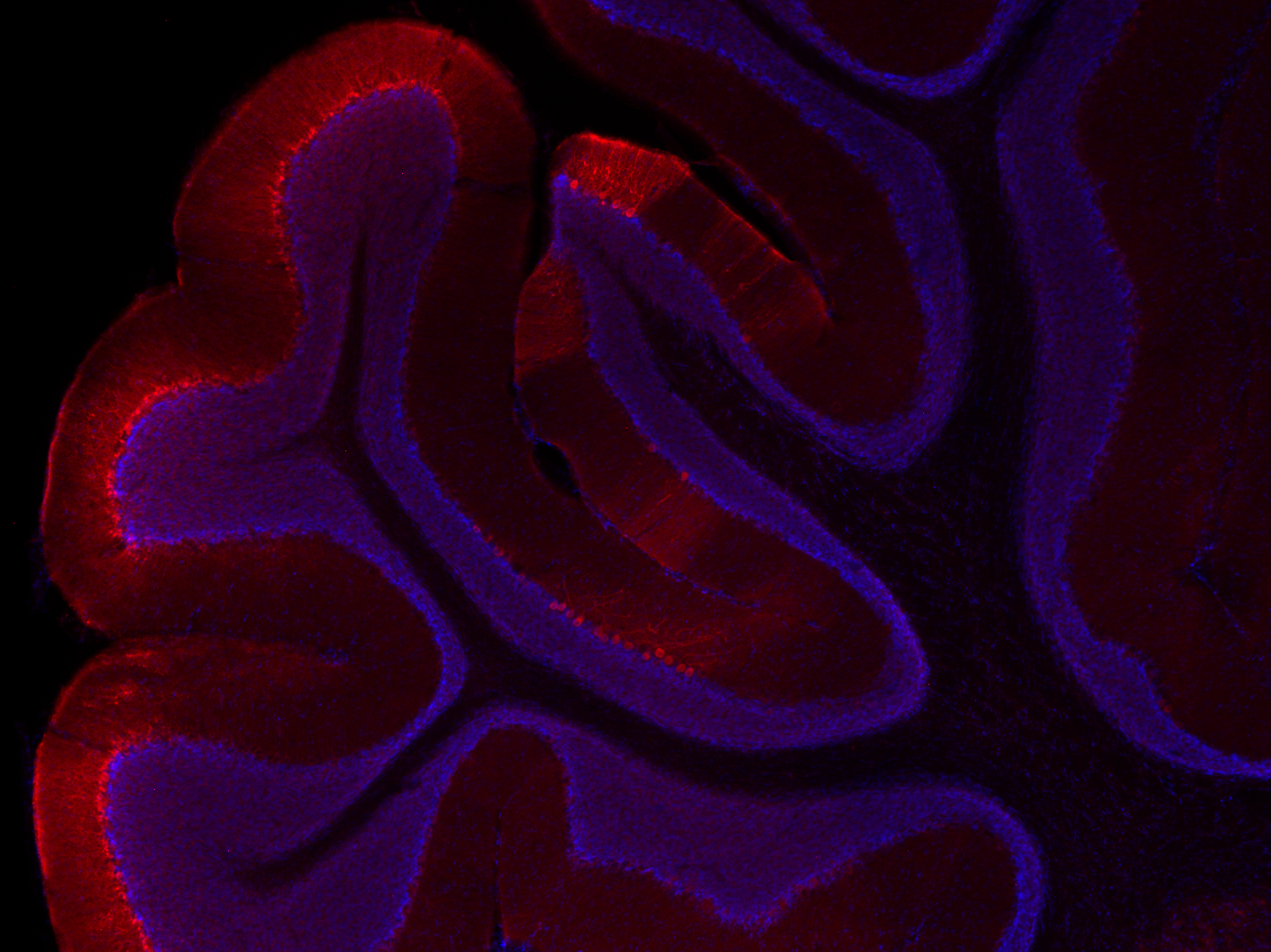 Aldolase C Polyclonal Guinea pig antiserum - image 5