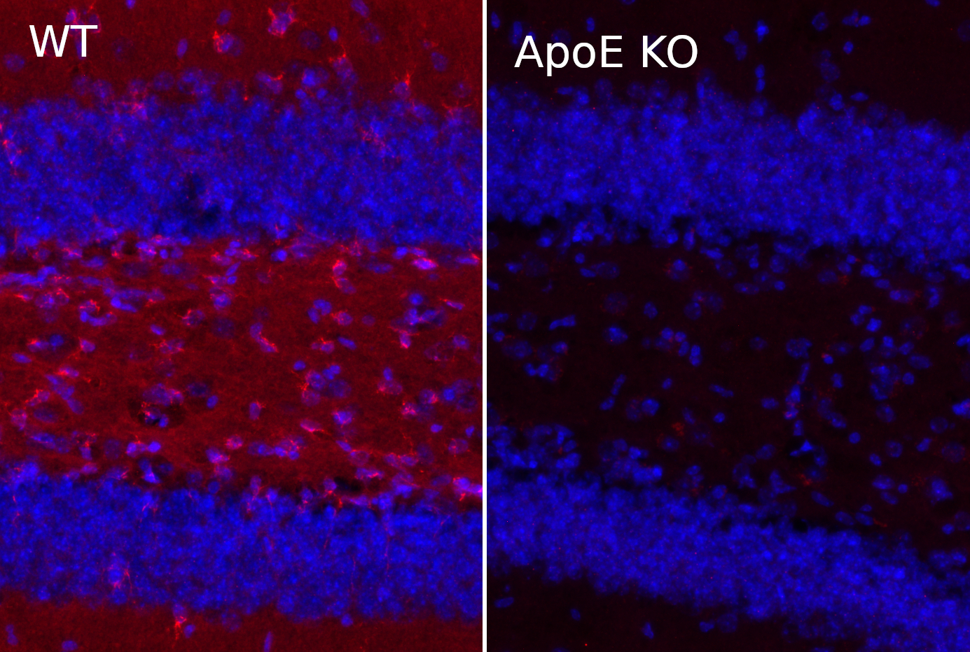ApoE, Polyclonal Guinea pig antiserum