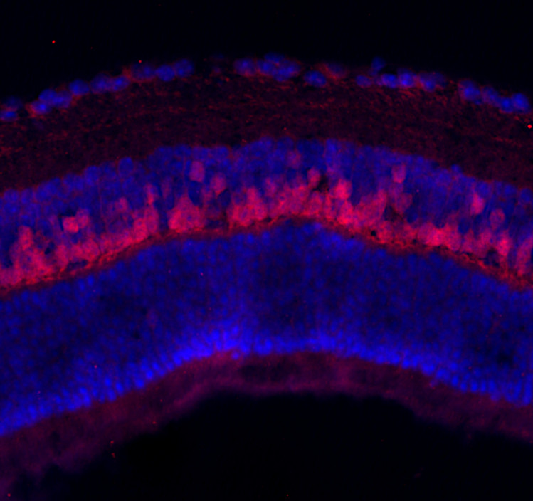 CaBP5, Polyclonal rabbit antiserum
