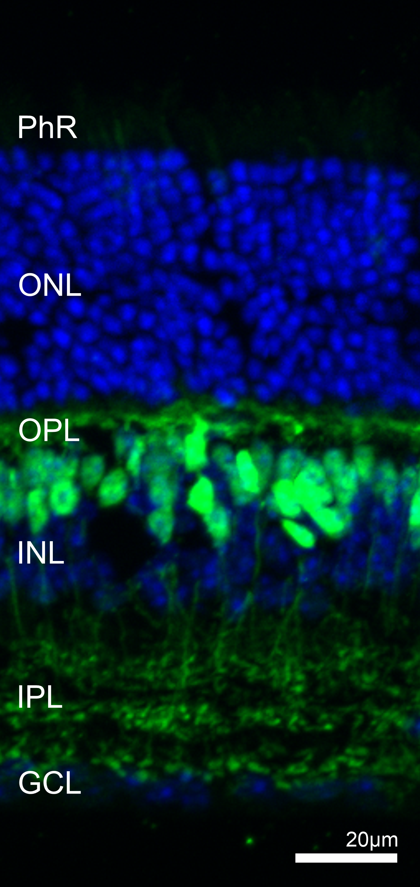 CaBP5, Polyclonal rabbit antiserum