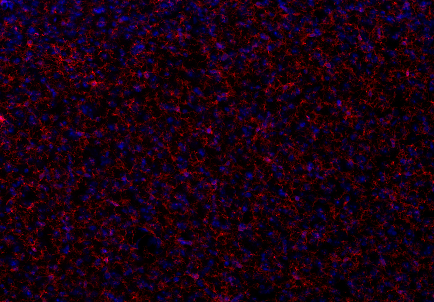 P2Y12 Recombinant rabbit - image 1
