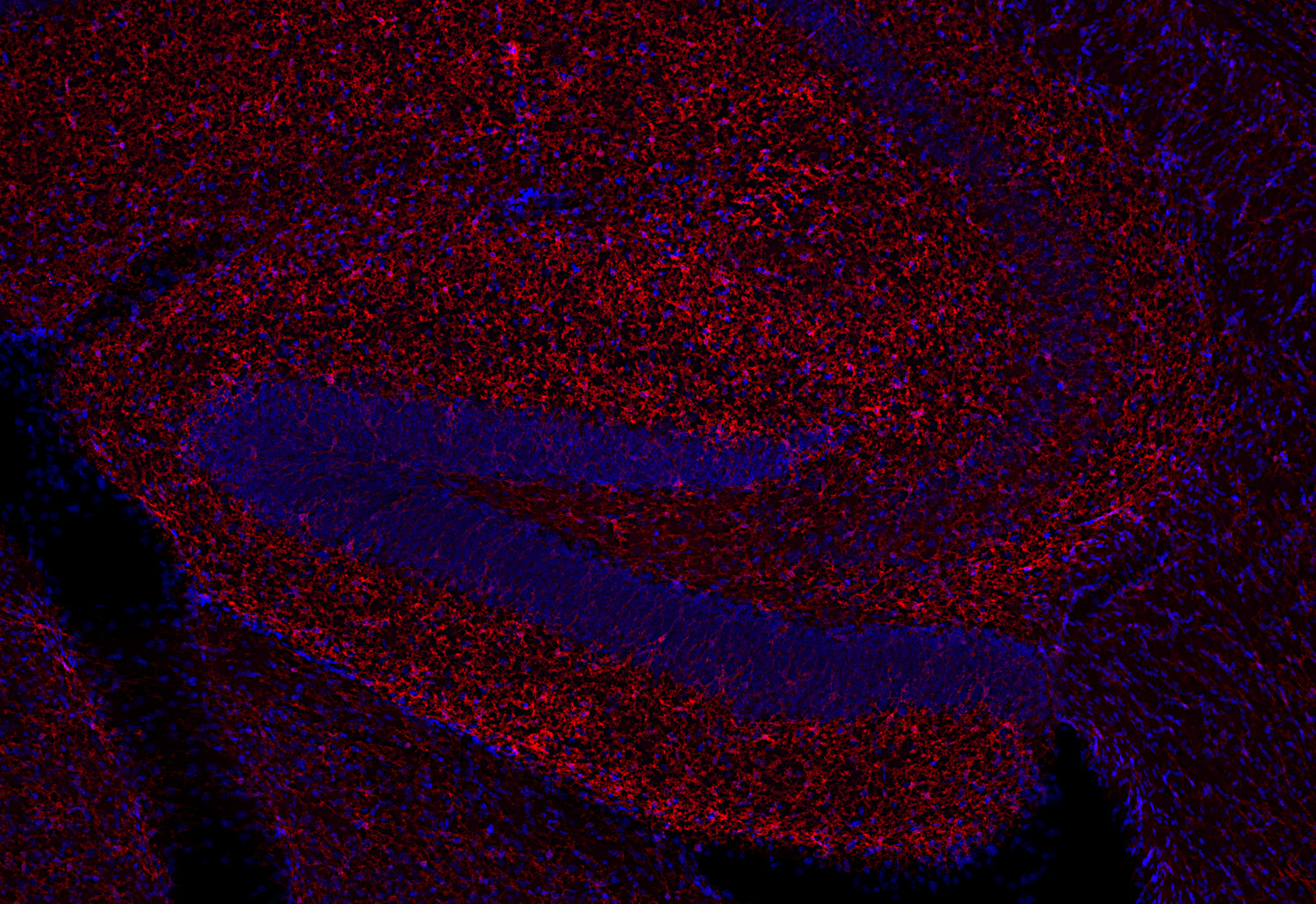 P2Y12 Recombinant rabbit - image 2