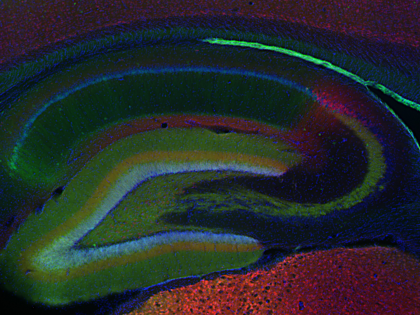 PCP4, Polyclonal Guinea pig antiserum