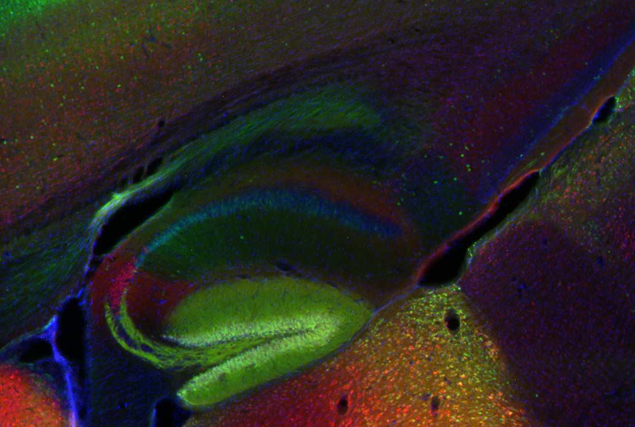 PCP4, Polyclonal Guinea pig antiserum