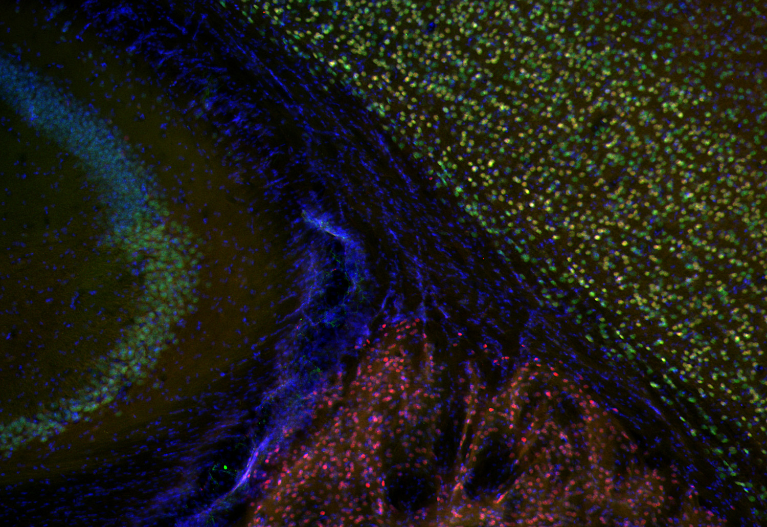 FoxP2, Polyclonal Guinea pig antiserum