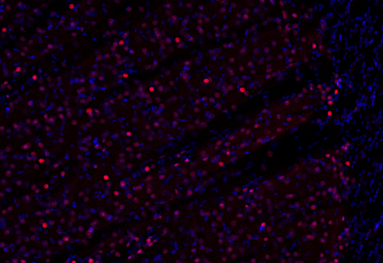 FoxP2, Polyclonal Guinea pig antiserum