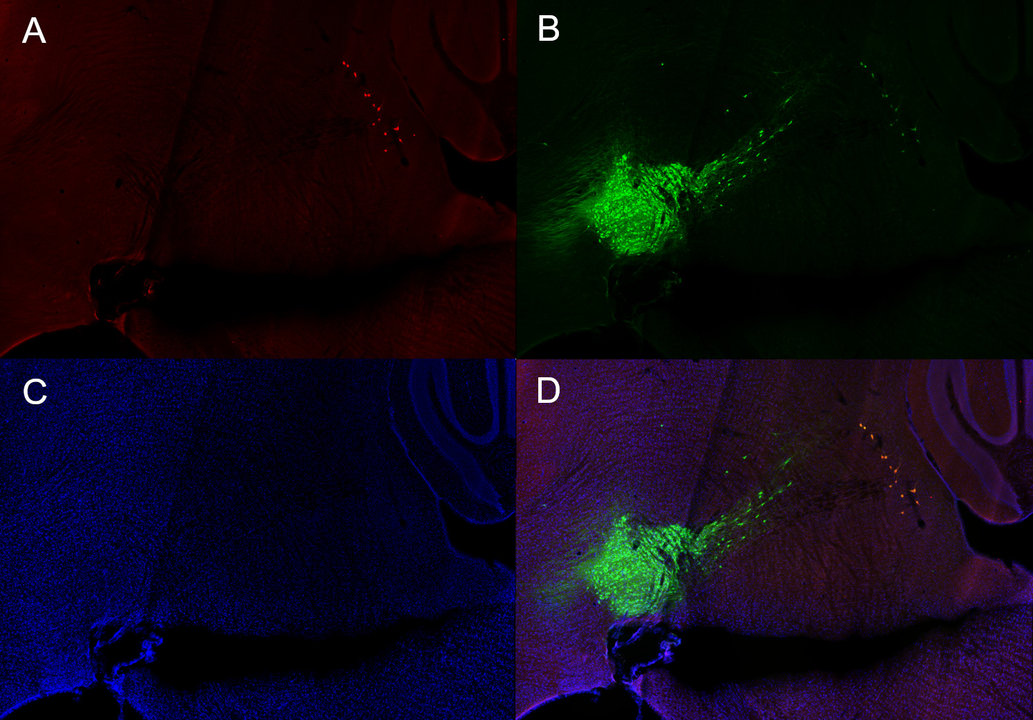 Dopamine beta-hydroxylase Polyclonal Guinea pig antiserum - image 1