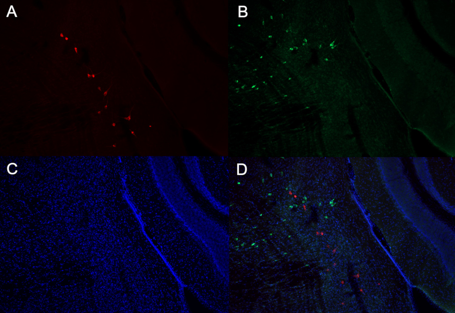 Dopamine beta-hydroxylase Polyclonal Guinea pig antiserum - image 2