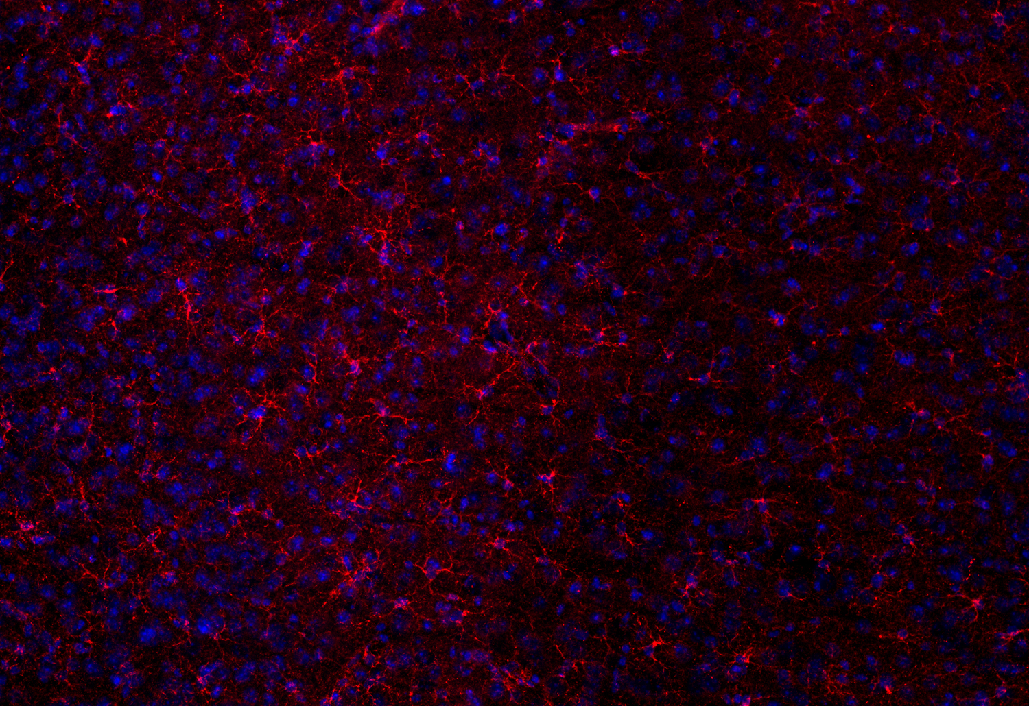 Glutamate dehydrogenase Polyclonal Guinea pig antiserum - image 4