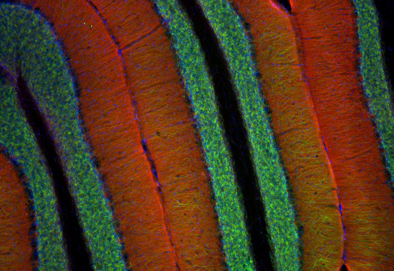 L1CAM, Recombinant rabbit