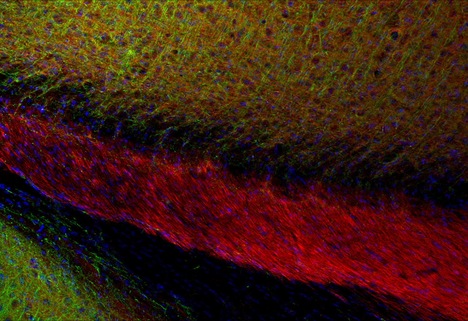 L1CAM, Recombinant rabbit