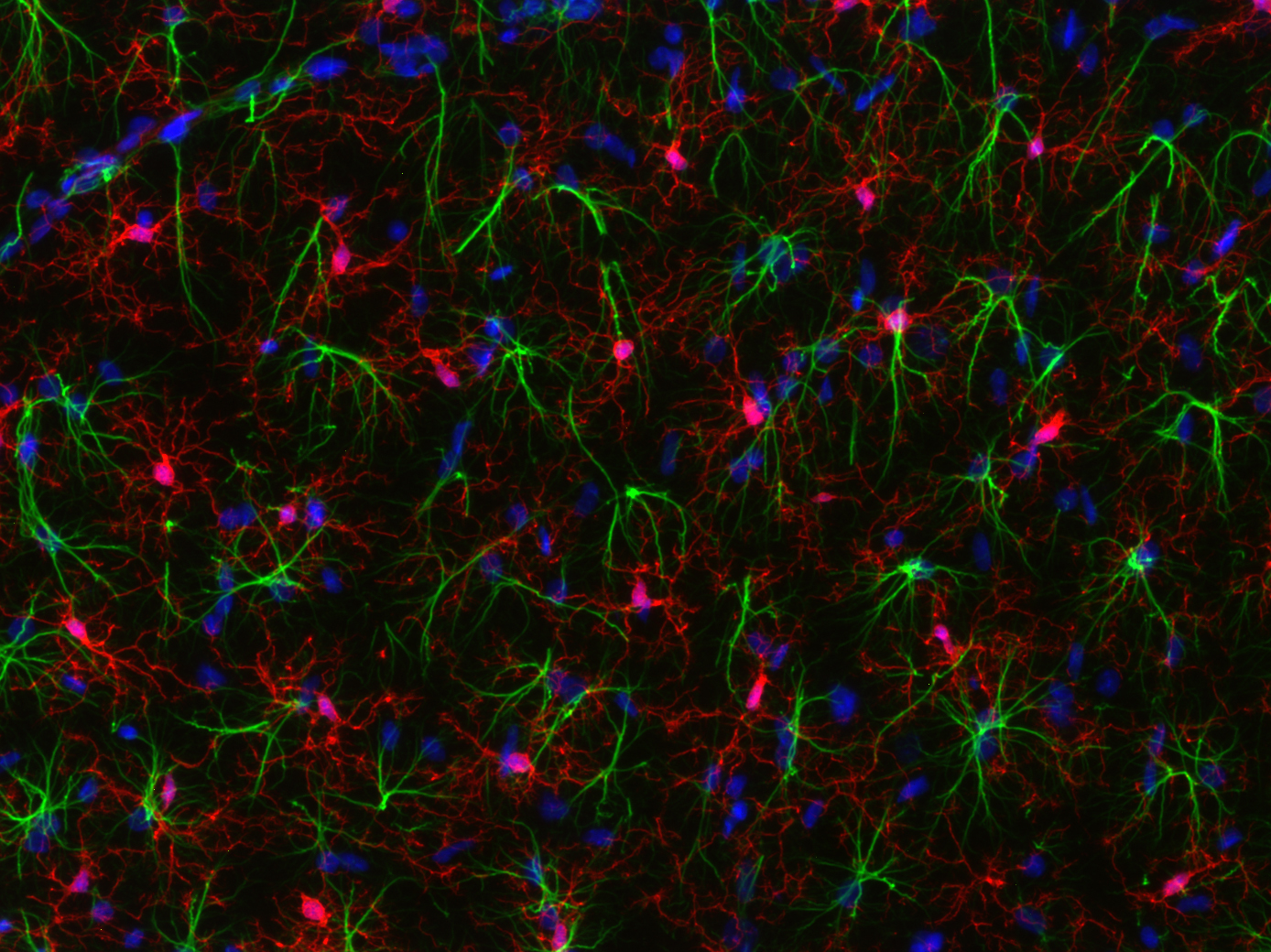 IBA1 Recombinant rabbit - image 5