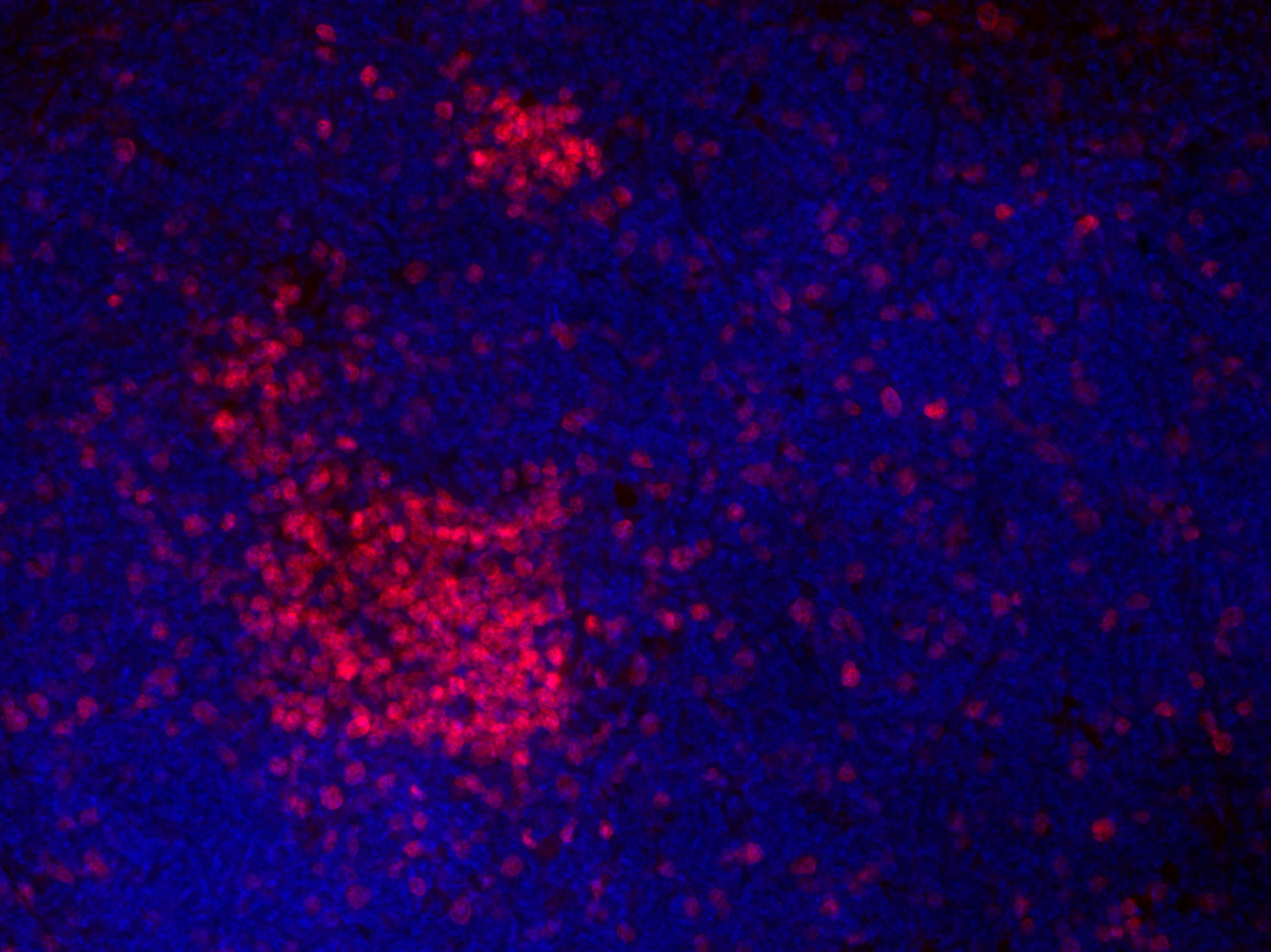 Ki67 Recombinant rabbit - image 2