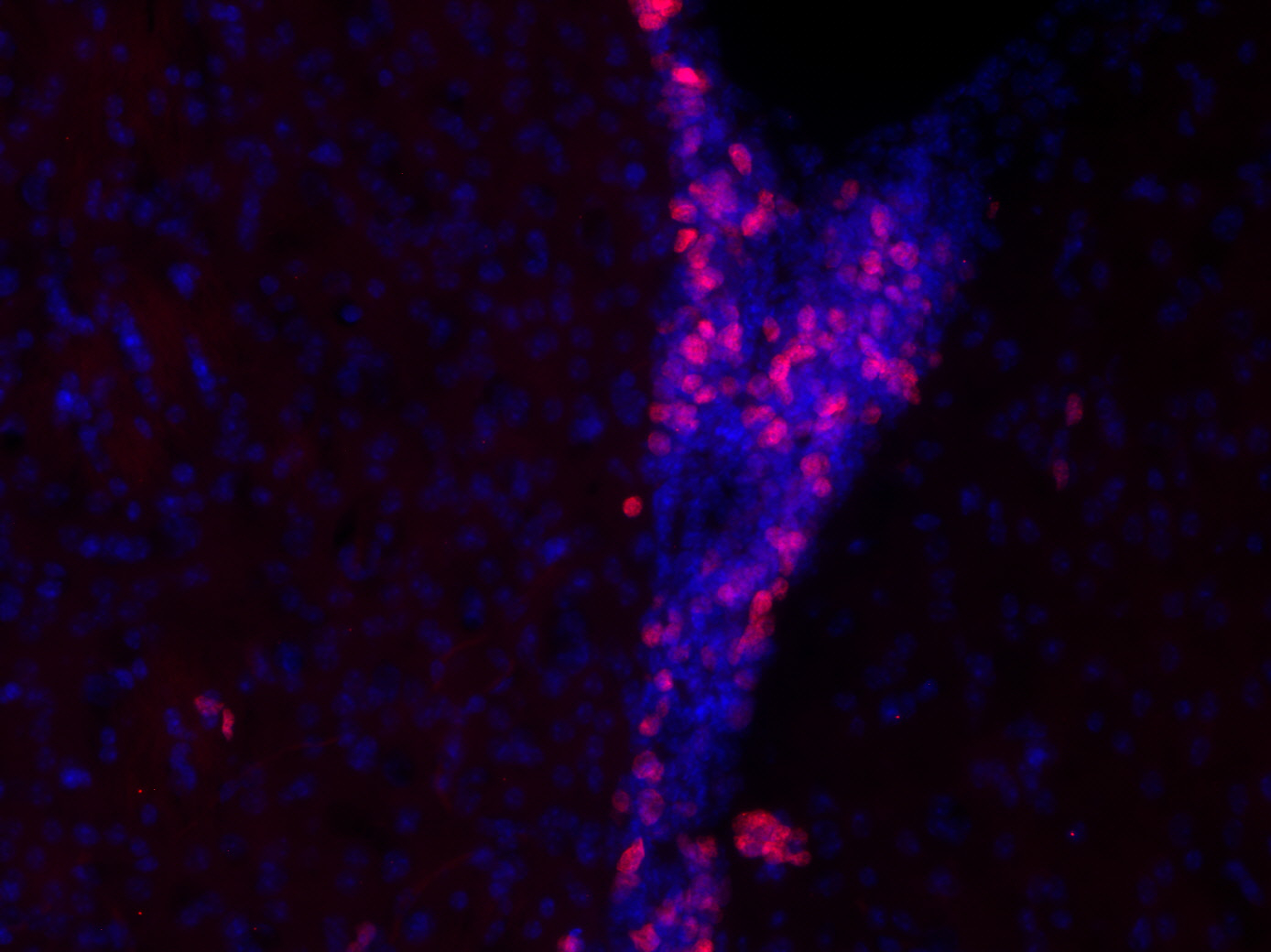 Ki67 Recombinant rabbit - image 3