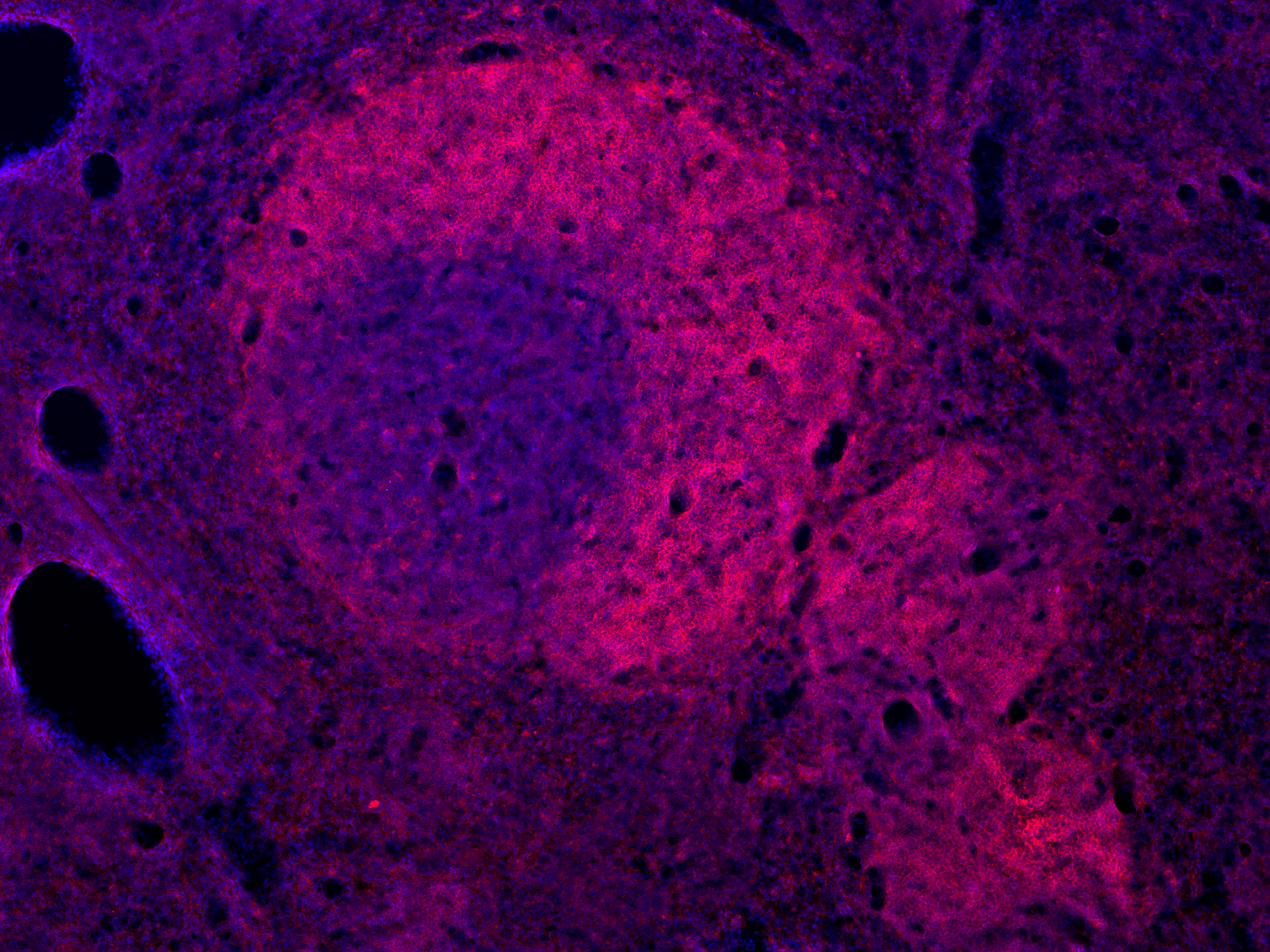 CD19, Recombinant rabbit