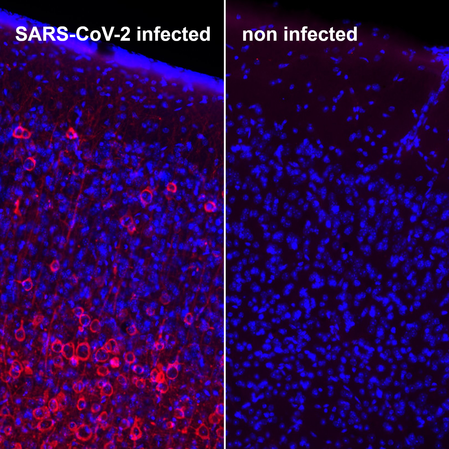 Nucleocapsid CoV-2 Monoclonal mouse purified IgG - image 4
