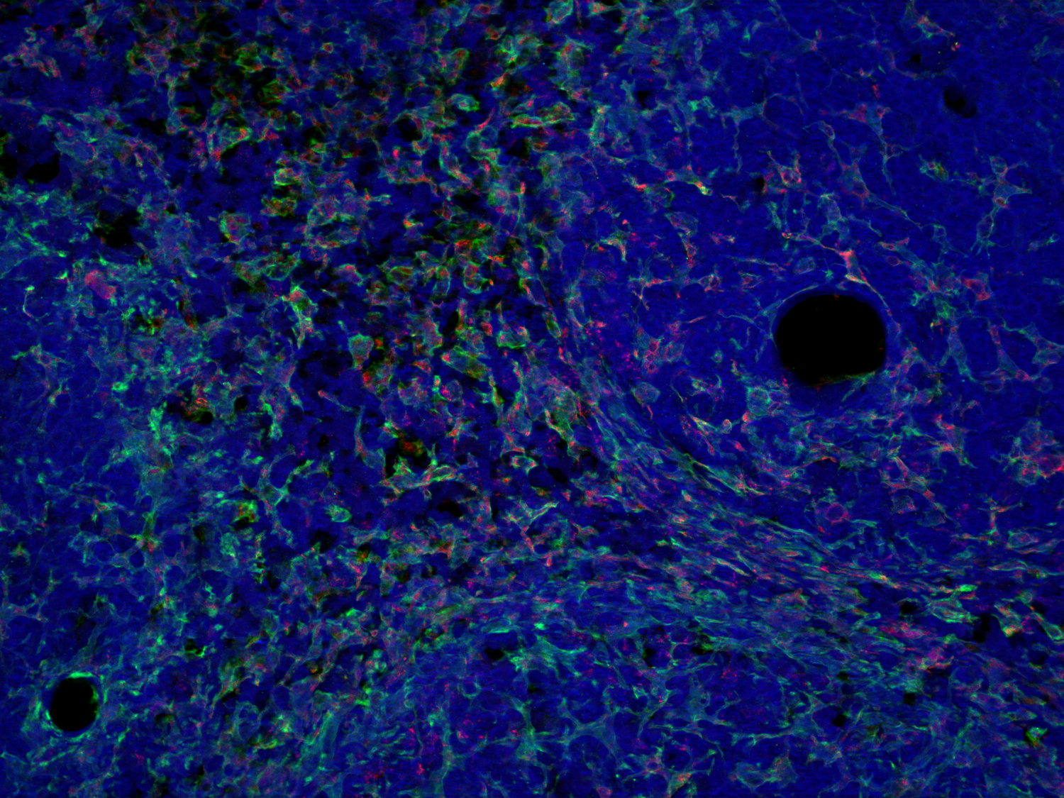 CD68, Polyclonal Guinea pig antiserum