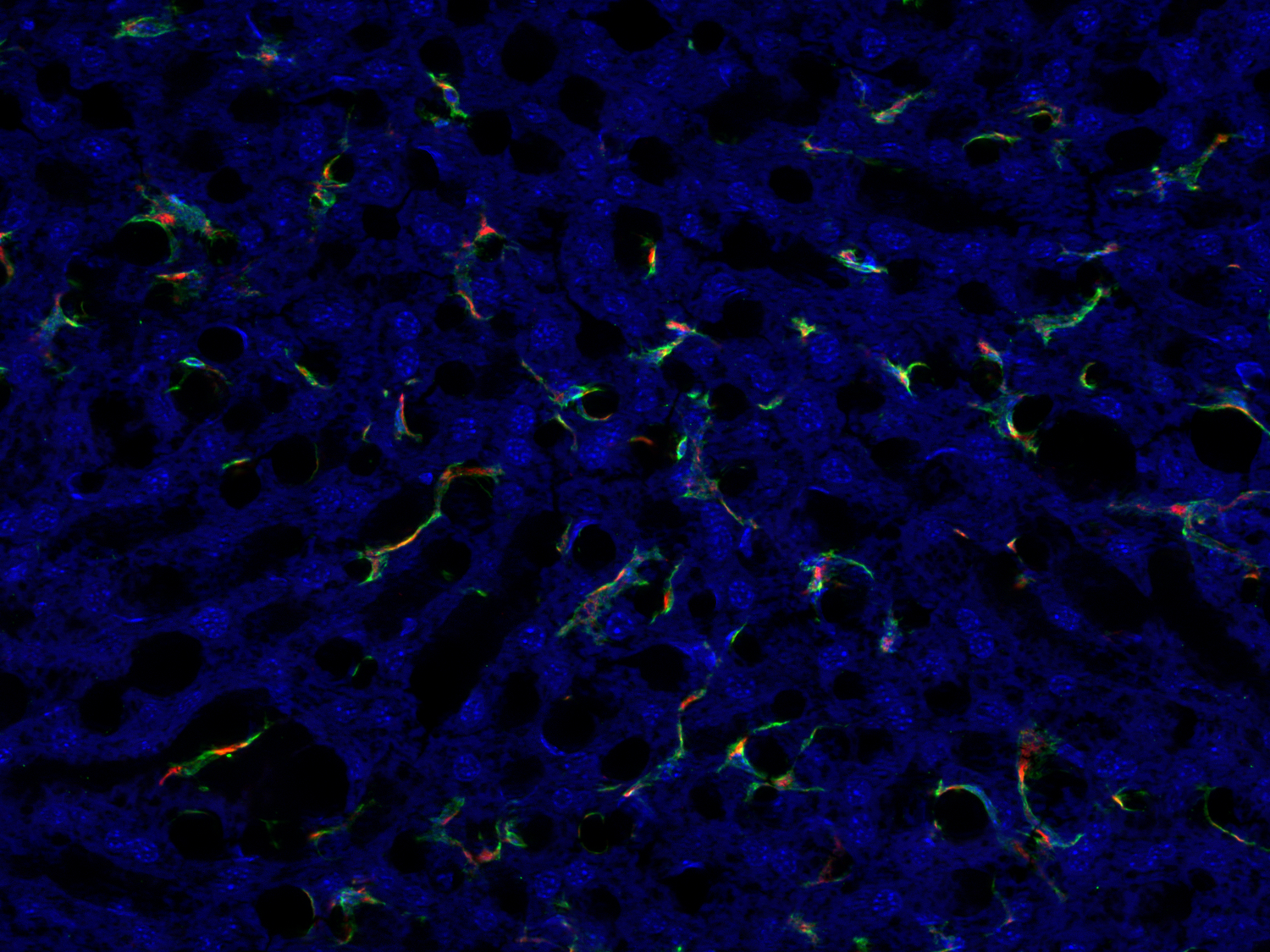 CD68, Polyclonal Guinea pig antiserum