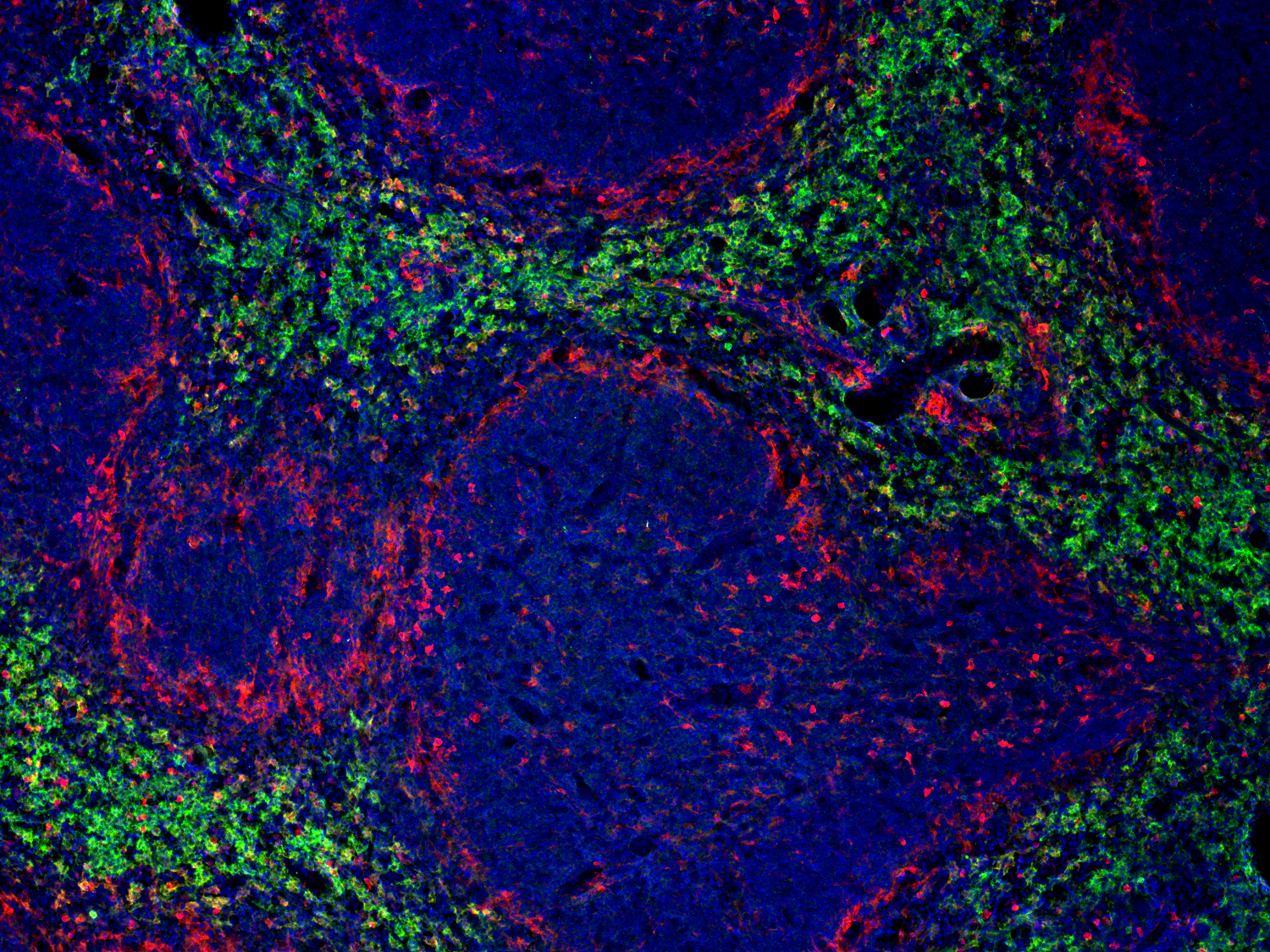 Galectin-3 Recombinant rabbit - image 3