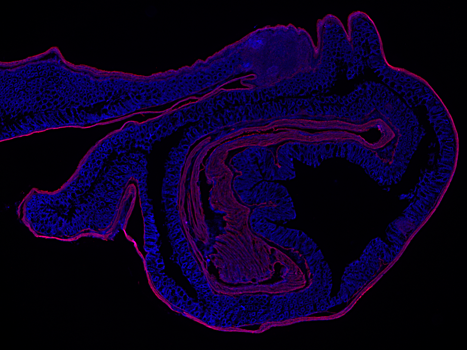 Desmin Monoclonal rabbit - image 3