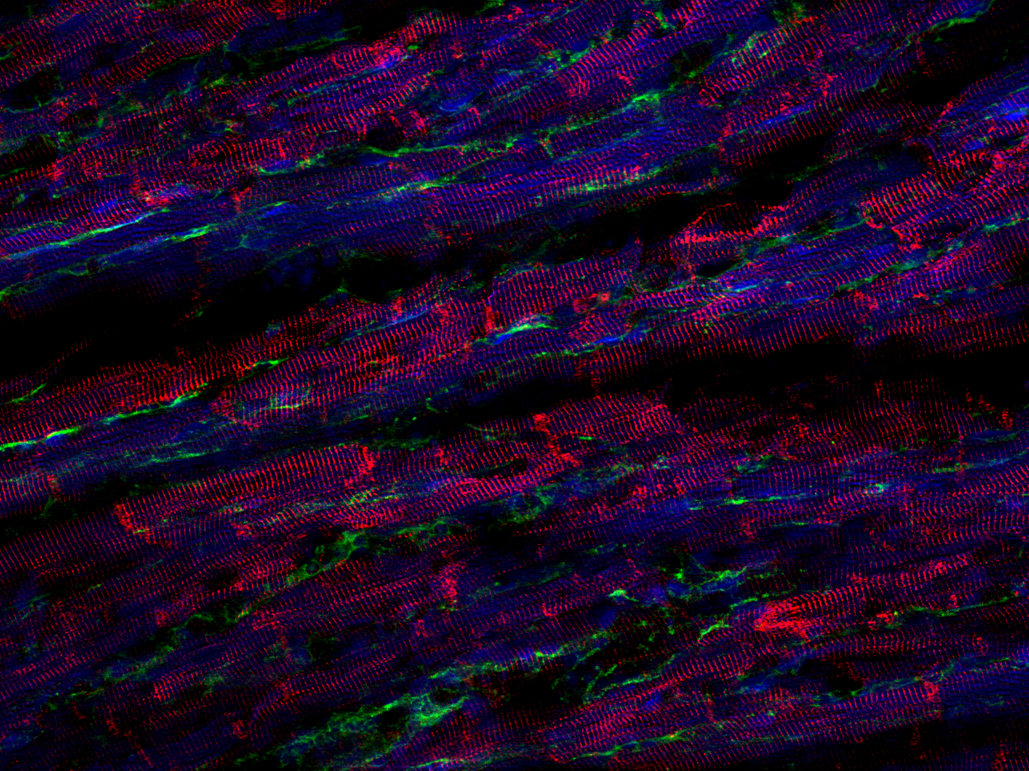 Desmin Monoclonal rabbit - image 4