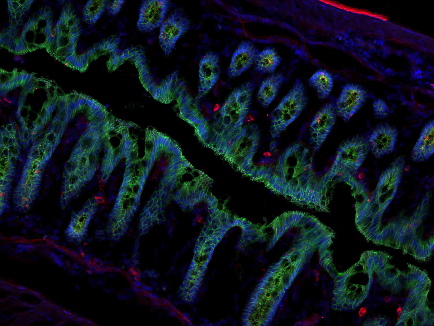 DPP4, Polyclonal Guinea pig antiserum