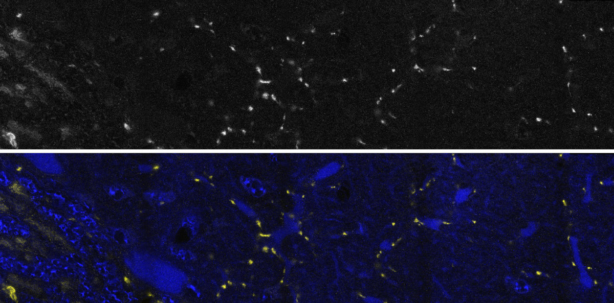 135402-ihc2.jpg