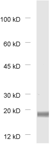 Synaptobrevin1 Polyclonal Guinea pig antiserum - image 1
