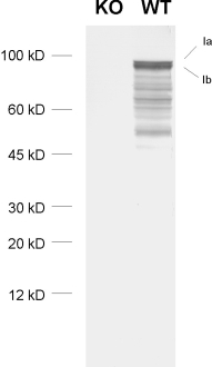 Synapsin1 Polyclonal Guinea pig antiserum - image 1