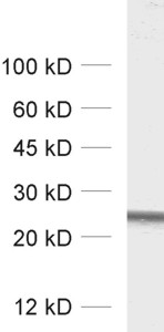 Rab5 Polyclonal rabbit antiserum - image 1