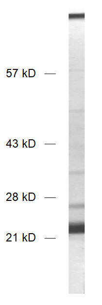 SNAP23 Polyclonal rabbit antiserum - image 1