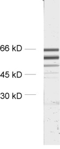 Munc18-2 Polyclonal rabbit antiserum - image 1