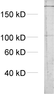 IP3-receptor type1 Polyclonal rabbit antiserum - image 1