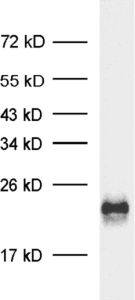 Complexin4 Polyclonal rabbit antiserum - image 1