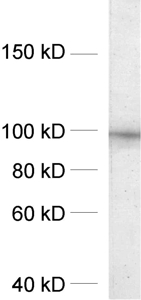 PSD93 Polyclonal rabbit antiserum - image 1