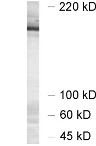 Munc13-1 Polyclonal Guinea pig antiserum - image 1