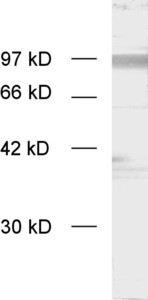 APP Polyclonal rabbit purified antibody - image 1